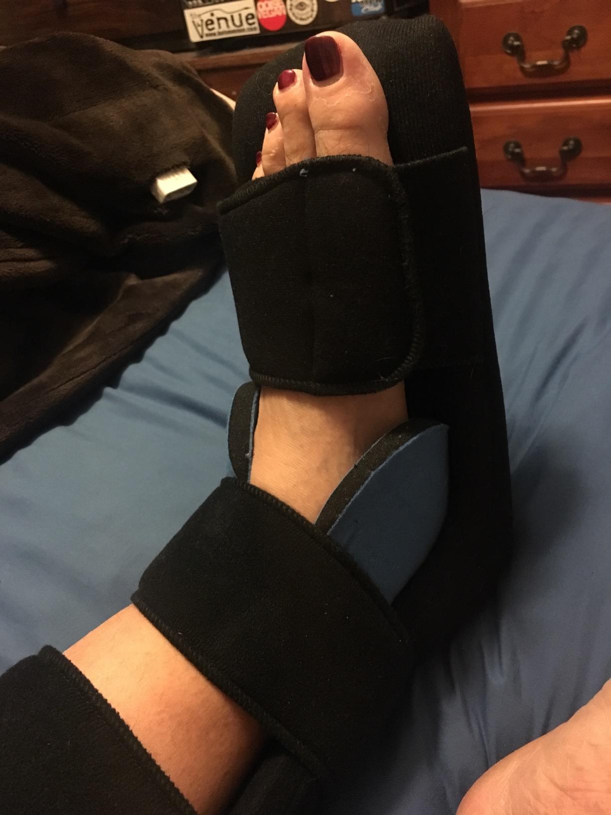 Vive Plantar Fasciitis Night Splint Plus Trigger Point Stretch Wedges - Soft Leg Brace Support, Orthopedic Sleeping Immobilizer Stretch Boot (Medium: Men's: 5.5-8, Women's 7-9.5) customer photo 2