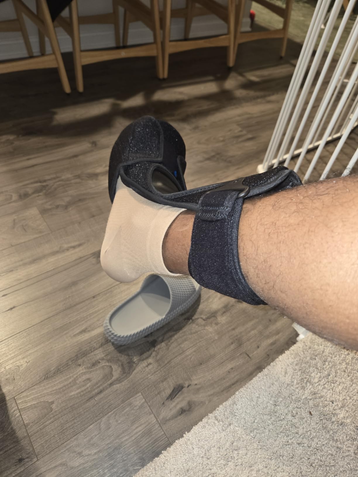 Ovation Medical Hybrid Night Splint - Comfortable and Supportive Plantar Fasciitis Night Splint - Premium Nighttime Foot Brace for Heel Pain - Combination Posterior and Dorsal (Small-Medium) customer photo 2