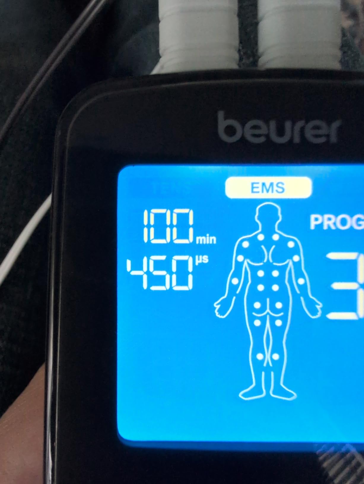 Beurer EM49 Digital TENS & EMS Device for Pain Relief and Muscle Stimulation, 15 TENS Programs, 35 EMS Programs, 2 Adjustable Channels with 4 Self-Adhesive Electrodes customer photo 2