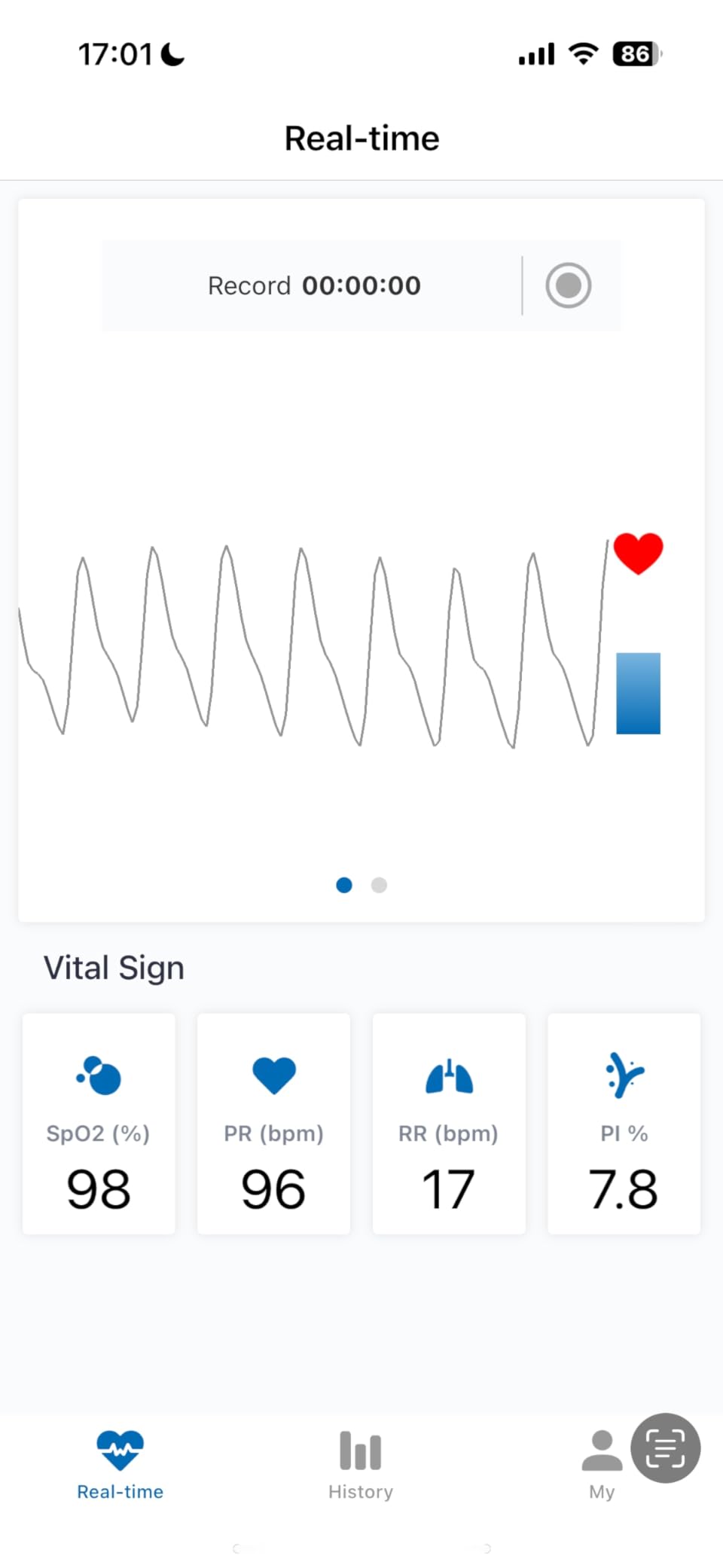 Innovo iP900BP-B Fingertip Pulse Oximeter, Blood Oxygen Monitor with Free App, Plethysmograph, and Perfusion Index (with Bluetooth) customer photo 2