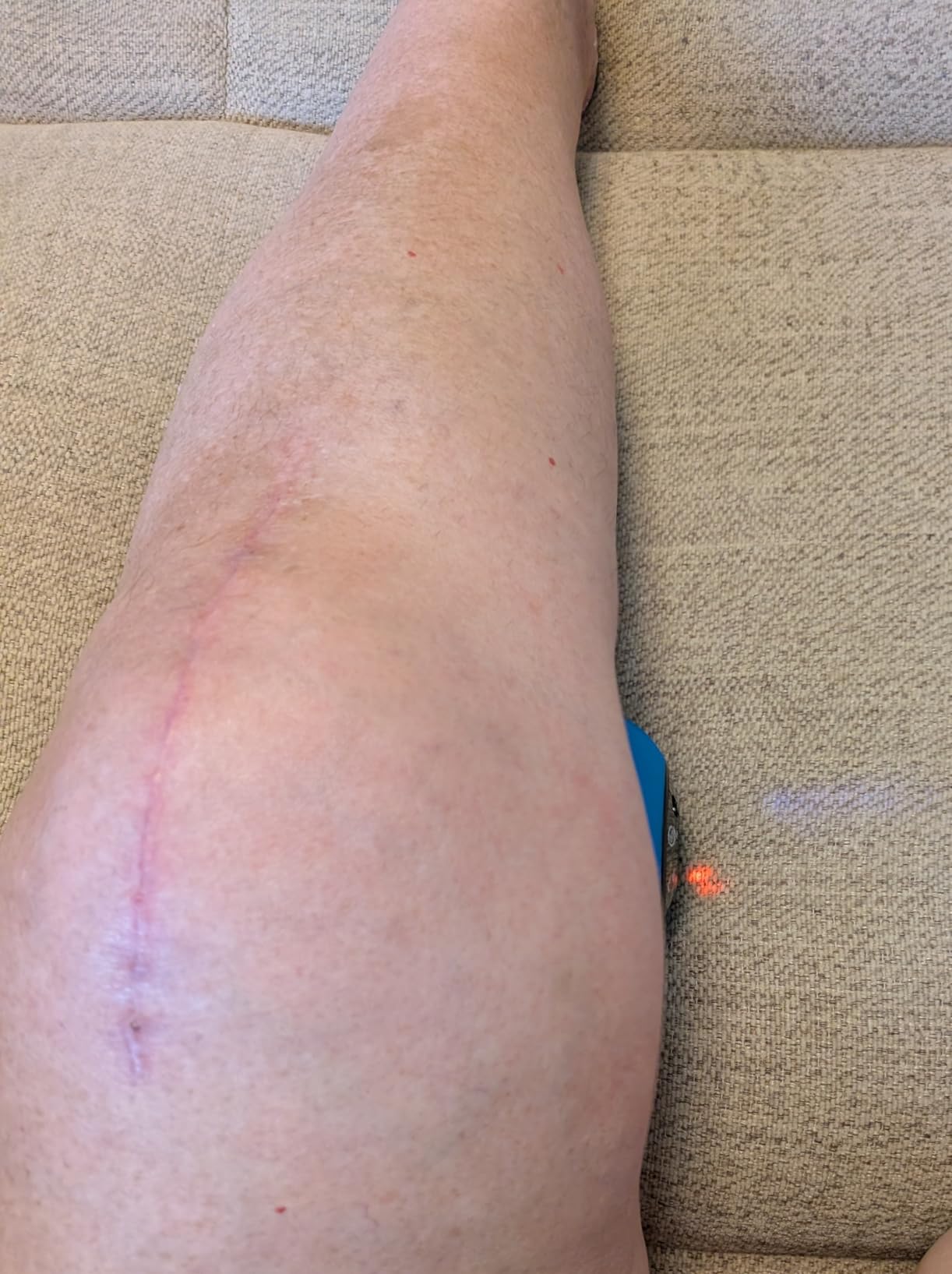 Rolling With It Vibrating Peanut Massage Ball - Deep Tissue Trigger Point Therapy customer photo 2