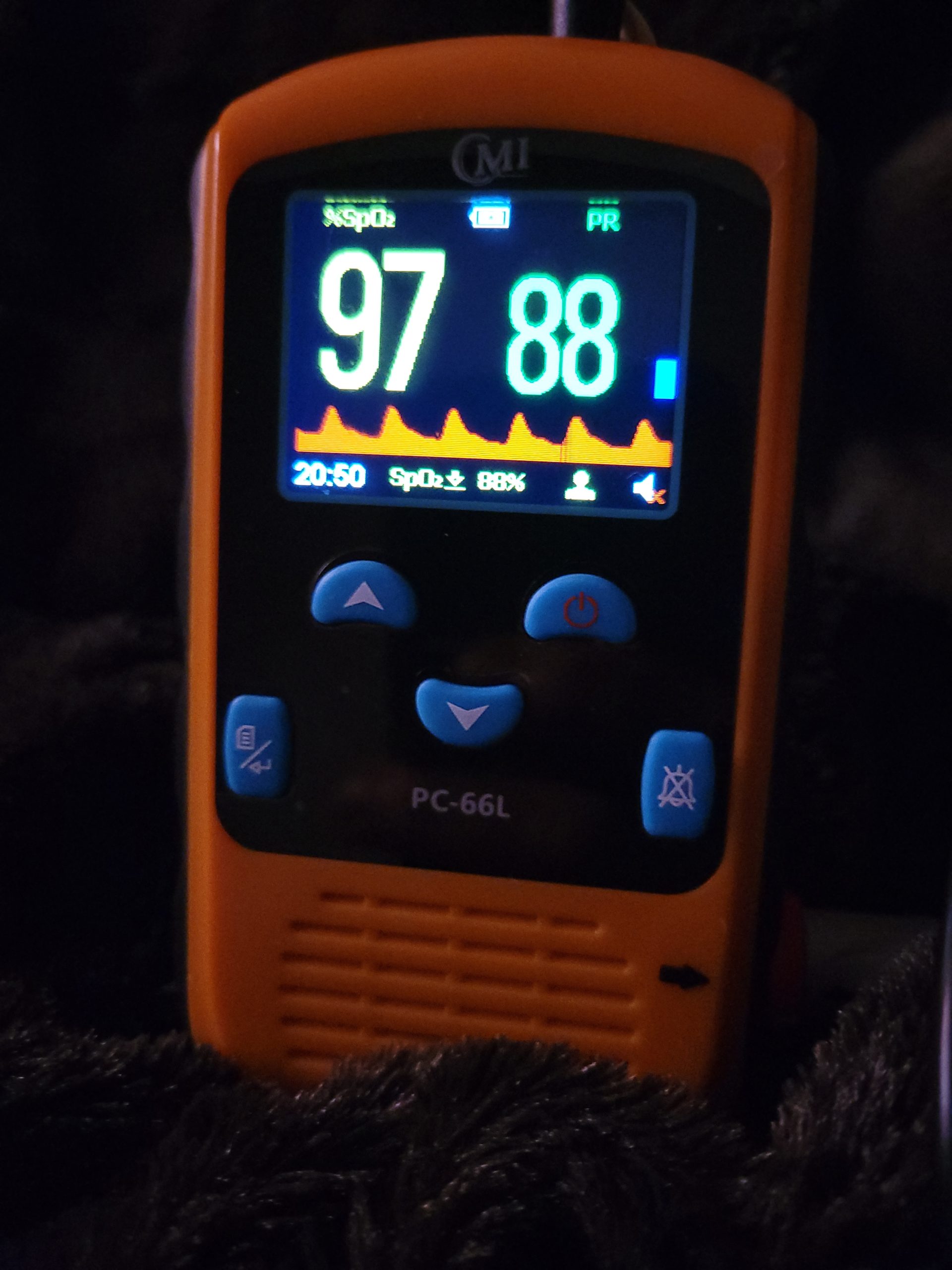 CMI Health Rechargeable Finger Pulse Oximeter for Adults, Continuous SpO2 & Pulse Rate Readings, Spot Check Mode, Adjustable Alerts, Ideal for Sports, Aviation & Wellness, Carry Case and AC Adapter Included customer photo 1