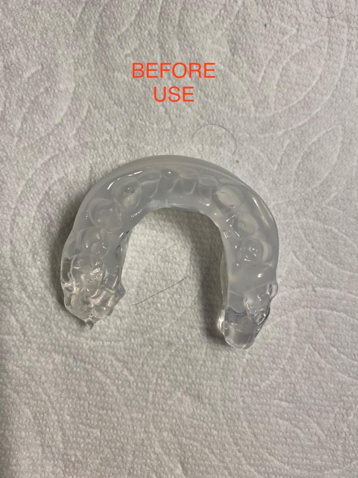 PureSleep, The Original Anti-Snoring Mouthpiece and #1 Solution Worldwide customer photo 2