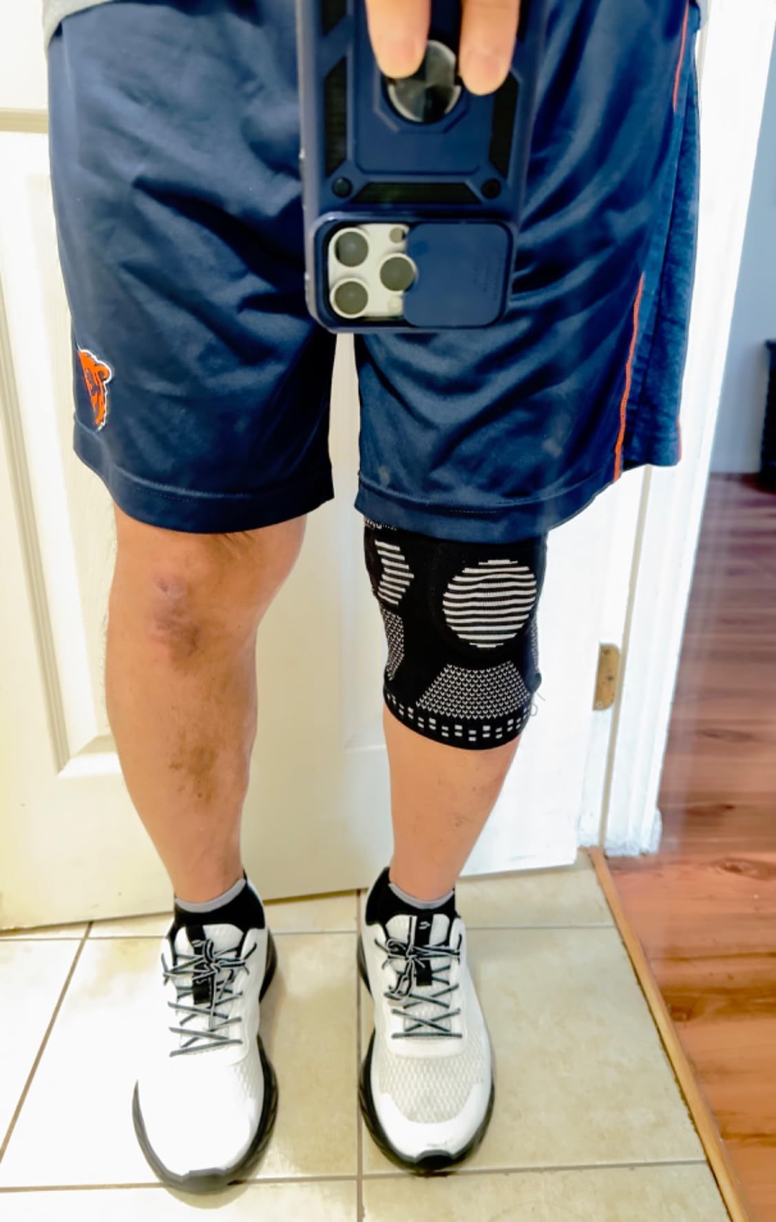 NEENCA Professional Knee Brace, Compression Knee Support with Patella Gel Pad & Side Stabilizers, Medical Knee Sleeve for Pain Relief, ACL, PCL, Meniscus, Injury Recovery, Arthritis, Sports, Workout customer photo 1