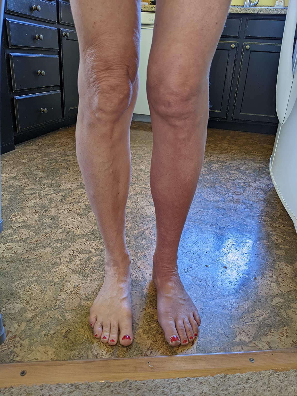Therabody JetBoots Prime Wireless Compression Boots Leg Massager Recovery | Pneumatic Leg Compression for Circulation & Pain Relief, FDA Cleared, 4 Pressure Levels | Short, 27-32in Leg Length customer photo 1