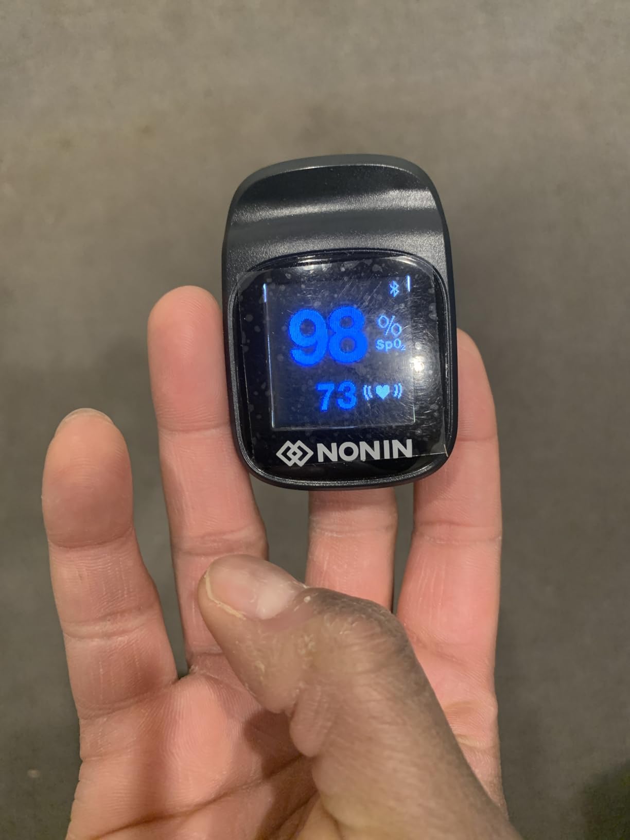 Nonin TruO2 OTC Pulse Oximeter 3250 - FDA-Cleared Blood Oxygen Monitor, Medical-Grade Accuracy, Fingertip Pulse Oximeter, Apple Health Compatible customer photo 1