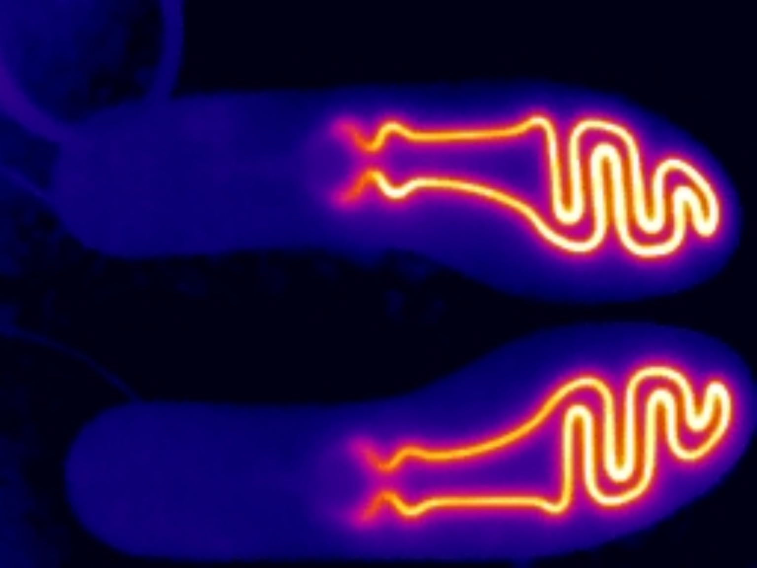 Dr.warm Rechargeable Heated Insoles, APP Remote Control Thermal Electric Insoles Battery Powered Foot Warmers for Men Women Outdoor Hunting Fishing Camping customer photo 2